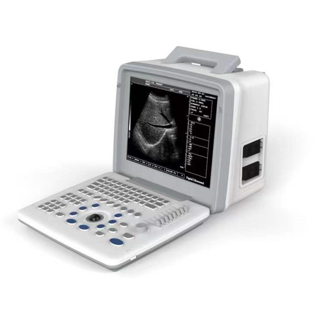 s300ultrasoundmachine.png